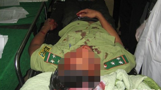 Cán bộ bị lâm tặc chém vẫn đang phải điều trị đặc biệt