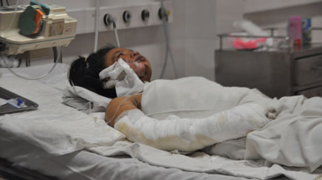 Bé gái bán vé số bị mẹ tưới xăng đốt vẫn rất nguy kịch