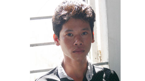 Đánh bạn nhậu chấn thương sọ não