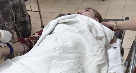 Đang đi với bạn trai, bị giật túi xách cắt đứt 4 gân tay