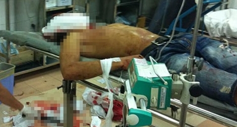 Mất mạng vì đùa cợt trong khi làm cỗ cưới 