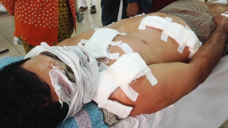 Chủ hãng nước đá bị tạt a xít khi ngồi quán cóc