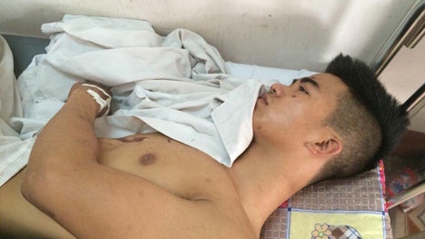 Bị cự tuyệt yêu, kẻ cuồng tình dùng mìn "cùng chết" với nữ sinh