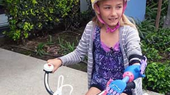 Sử dụng kỹ thuật in 3D lắp cánh tay giả chỉ với 1 triệu đồng