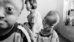 Hơn 1,3 tỷ đồng hỗ trợ nạn nhân chất độc da cam ở Đà Nẵng