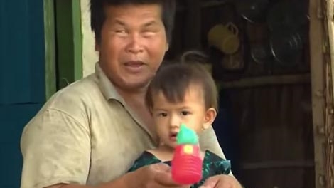 Người có biệt tài đoán thời tiết bằng... tai