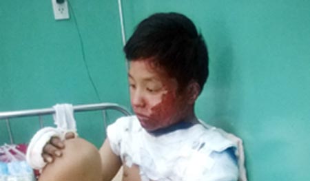 Người mẹ tẩm xăng đốt con vì trốn học chơi game online