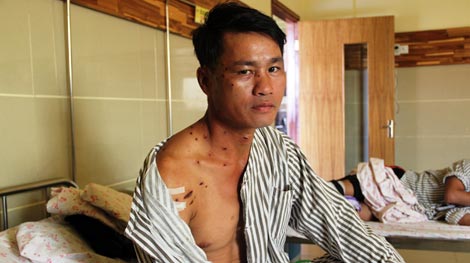 Thú rừng nổi điên tấn công thợ săn ở “vương quốc trâu hoang”