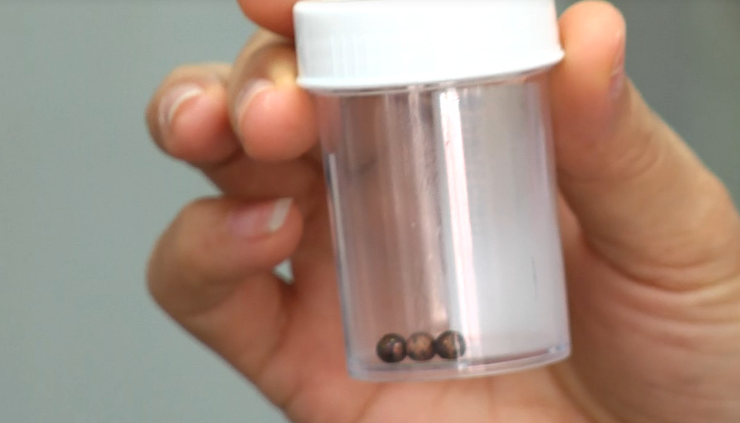 Bé trai suýt hoại tử dạ dày vì nuốt 3 viên bi trong trò chơi xếp hình