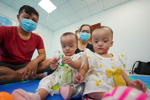 Cặp song sinh Trúc Nhi và Diệu Nhi chuẩn bị xuất viện