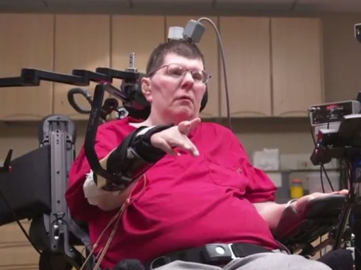 Công nghệ BrainGate2 hồi phục chức năng người bại liệt 