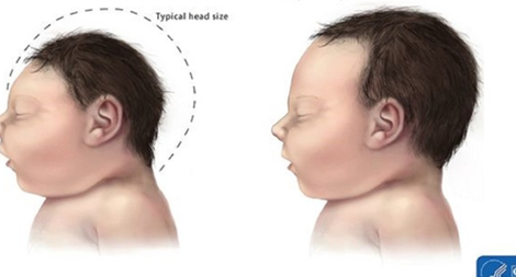 Nhiều dịch bệnh có nguy cơ bùng phát và những ứng phó mới cần đáp ứng