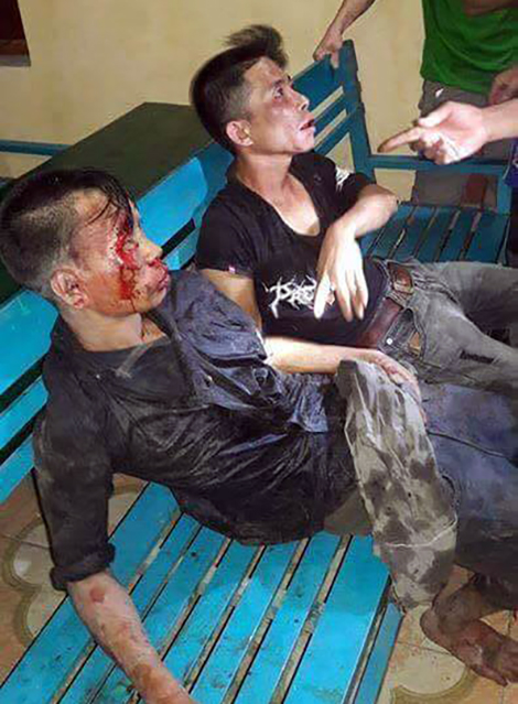 Đối tượng trộm chó giả chết tránh đòn khi bị dân vây bắt