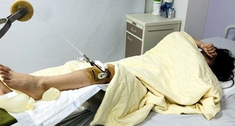 Lái xe Range Rover tông gãy chân nữ sinh tại Bà Triệu- Trần Nhân Tông "trốn" tại Quảng Ninh