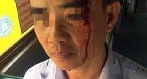 Tài xế xe buýt Công ty Vận tải hành khách Hải Hưng đánh người nhập viện