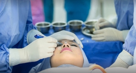 Biến chứng do tiêm filler tại cơ sở thẩm mỹ