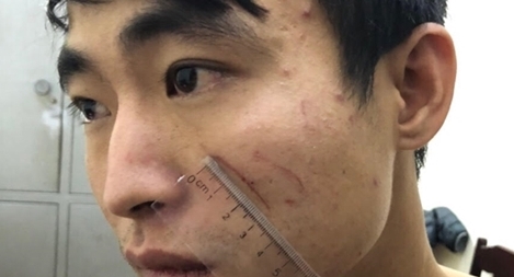 Hé lộ nguyên nhân đối tượng sát hại người yêu trong nhà nghỉ ở Sầm Sơn