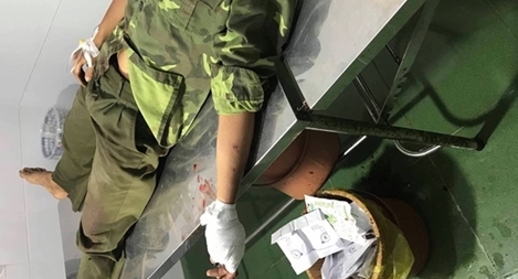 Hàng chục “lâm tặc” vây chém kiểm lâm để giải cứu đồng bọn