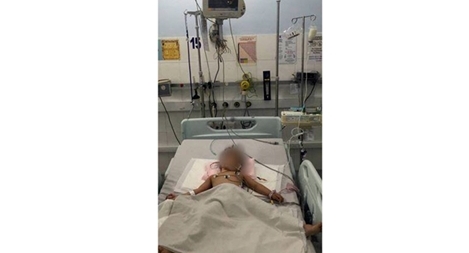 Ứng dụng máy ECMO cứu sống bệnh nhi nhỏ nhất mắc bệnh nguy hiểm