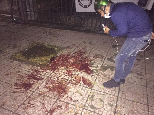 Mâu thuẫn giữa 2 nữ nhân viên, một thanh niên bị chém lìa cánh tay 