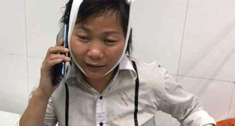 Nữ tài xế taxi bị 2 bảo vệ Bệnh viện đánh nhập viện