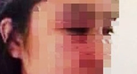 Bộ Y tế yêu cầu làm rõ vụ “bác sĩ bị tố hành hung nữ điều dưỡng”