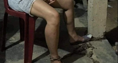 Chồng say xỉn thường xuyên đánh đập, dùng xích sắt trói vợ 