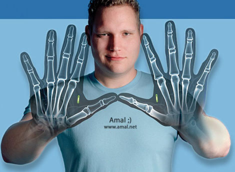 Cấy ghép hệ điều hành vào cơ thể người? 