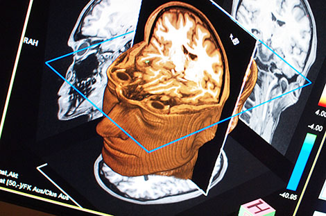 Cấu trúc não quyết định hành vi phạm tội?