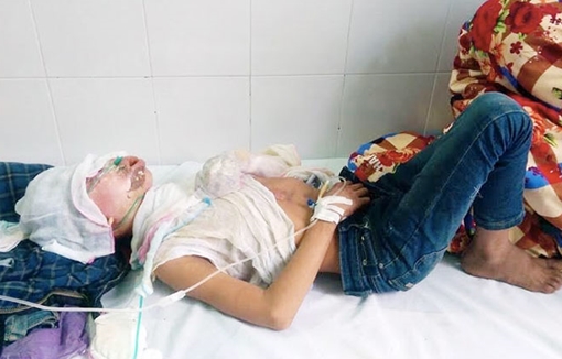 Bố dạy con bằng xăng, 2 bé trai bỏng nặng