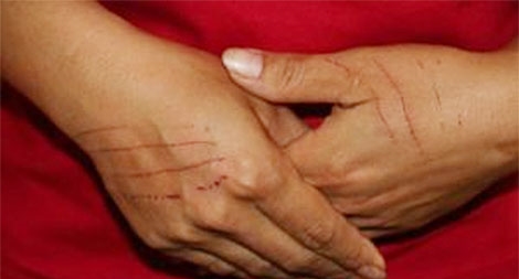 Kỳ 1: Có phải tôi là kẻ bệnh hoạn