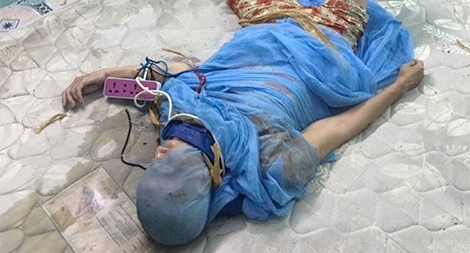 Đóng đinh vào đầu trị “ma nhập” - hậu quả của niềm tin mù quáng