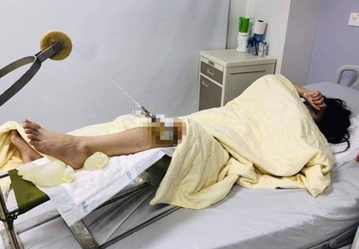 Tích cực điều tra vụ xe sang gây tai nạn cho nữ sinh viên rồi bỏ trốn