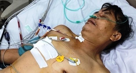 Cứu sống bệnh nhân ngực bị dập, chân bị nát do TNGT