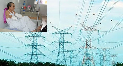Thảm họa mang tên “bỏng điện cao thế”