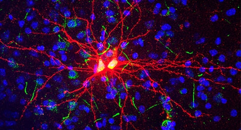 19 Khám phá mới về nỗi sợ: Những cơ chế thú vị