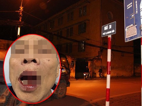 Cách chức cán bộ Sở Ngoại vụ Hà Nội hành hung cụ ông