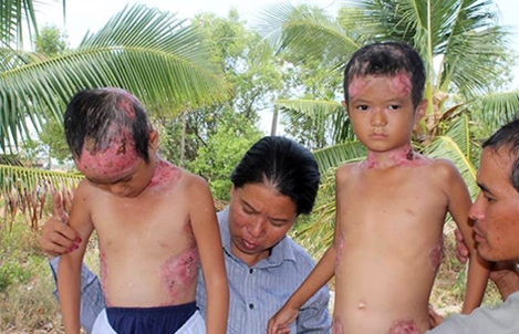 Hoàn cảnh tội nghiệp của hai cháu nhỏ mắc bệnh lạ