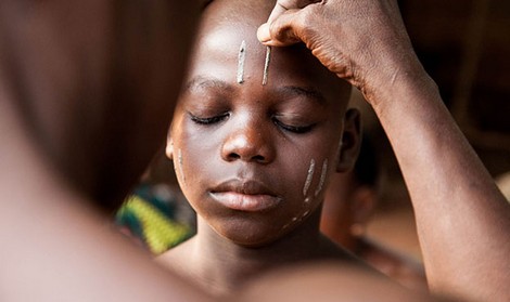 Phụ nữ tự hành xác để… làm đẹp