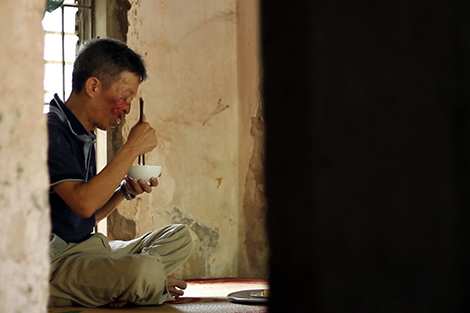 ‘Phép màu’ trả lại gương mặt cho người 10 năm bị u quái