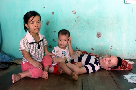 Chuyện tình buồn của đôi vợ chồng tật nguyền