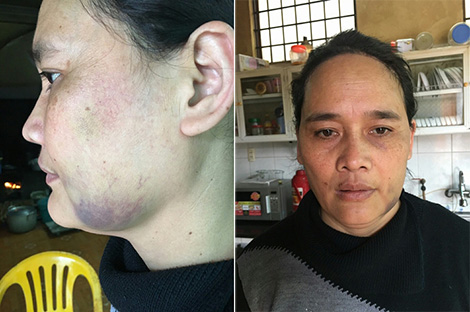 Nỗi đau tận cùng sau những cơn say