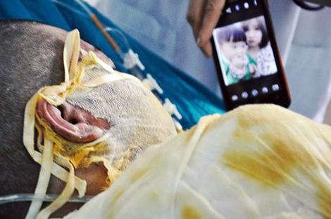 Đau lòng những vụ dùng xăng giải quyết mâu thuẫn tình cảm