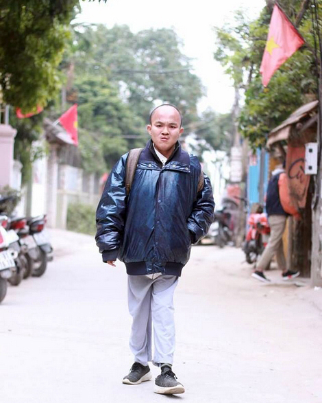 Chàng trai tật nguyền  đi bộ xuyên Việt
