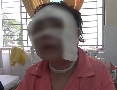 Đang chuẩn bị làm đám cưới thì bị kẻ lạ mặt tạt axit