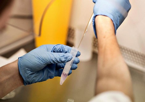 Hàng loạt vụ bác sĩ sử dụng tinh trùng của mình để “hỗ trợ sinh sản” cho bệnh nhân hiếm muộn