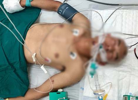 Tìm thân nhân bệnh nhân nghi vấn tai nạn giao thông tại Khánh Hòa