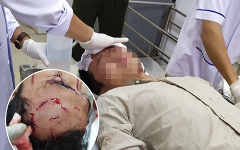 Xông vào trụ sở đánh trọng thương kiểm lâm