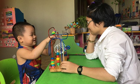 Cô gái mất gần nửa khuôn mặt trở thành người truyền cảm hứng