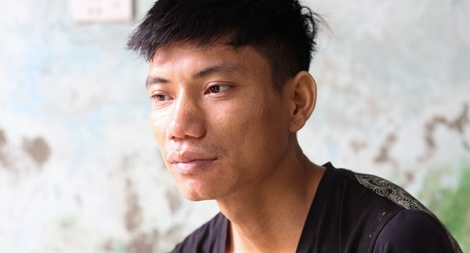 Cuộc đời bất hạnh của chàng trai chỉ lo "chết không ai biết"